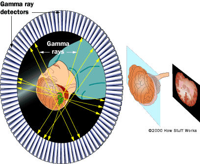 Two 511 keV photons which are detected in coincidence form a line of response (LOR).